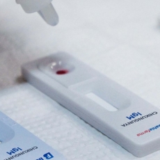 Anvisa deve suspender uso de testes de dengue distribuídos ao SUS