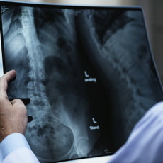 O coronavírus radiografou o Brasil e o diagnóstico não é nada bom