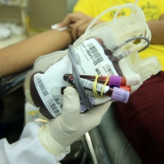 Entenda a PEC do Plasma, que permite a coleta e venda de componente do sangue