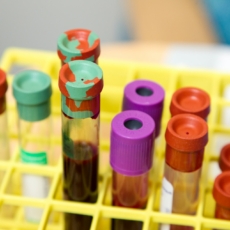 Pacientes com hemofilia aguardam disponibilização de tratamento no SUS