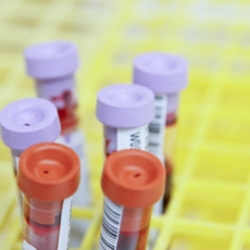 Exames toxicológicos podem ser exigidos pelas empresas?
