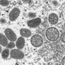 Anvisa autoriza dispensa de registro para vacinas e medicamentos contra monkeypox