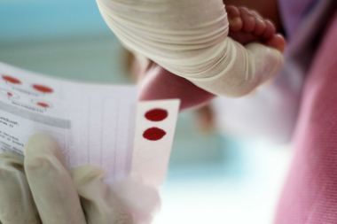 Tratamento inovador para fibrose cística será incorporado ao SUS