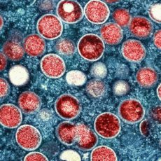 Doença Mpox: entenda quais são os riscos da emergência decretada pela OMS