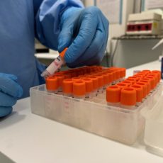 Mpox: Anvisa simplifica regras de medicamentos e vacinas importados pela Saúde