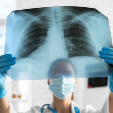 DPOC sufoca pacientes, sistema de saúde e previdência